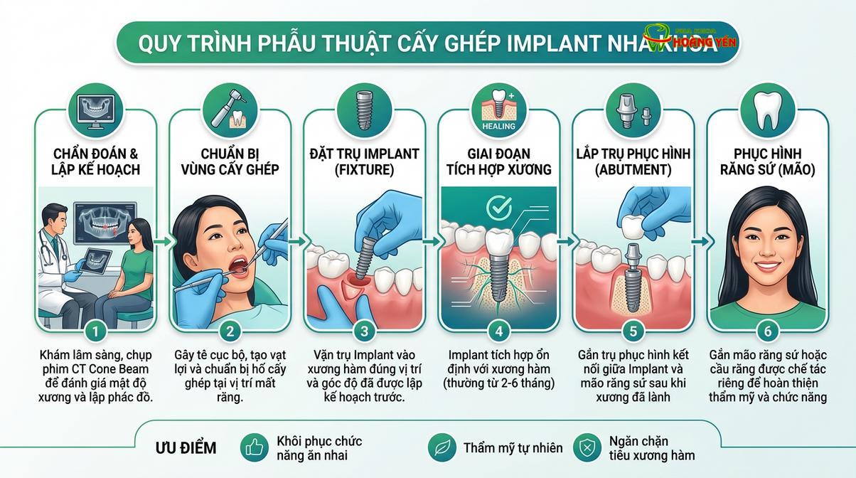 Quy trình cấy ghép và phục hình implant đòi hỏi sự chính xác trong từng giai đoạn.