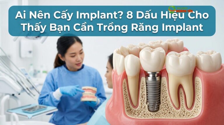 Ai Nên Cấy Implant? 8 Dấu Hiệu Cho Thấy Bạn Cần Trồng Răng Implant