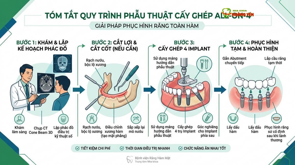 Mô phỏng các bước trong quy trình cấy ghép implant toàn hàm