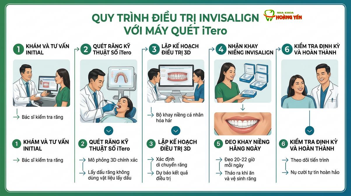 Quy trình quét dấu răng kỹ thuật số bằng máy iTero Element.