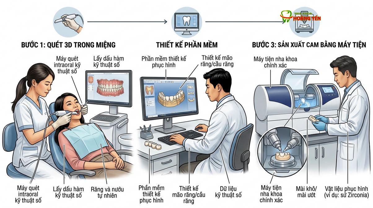Sơ đồ quy trình thiết kế và chế tác răng sứ kỹ thuật số khép kín.
