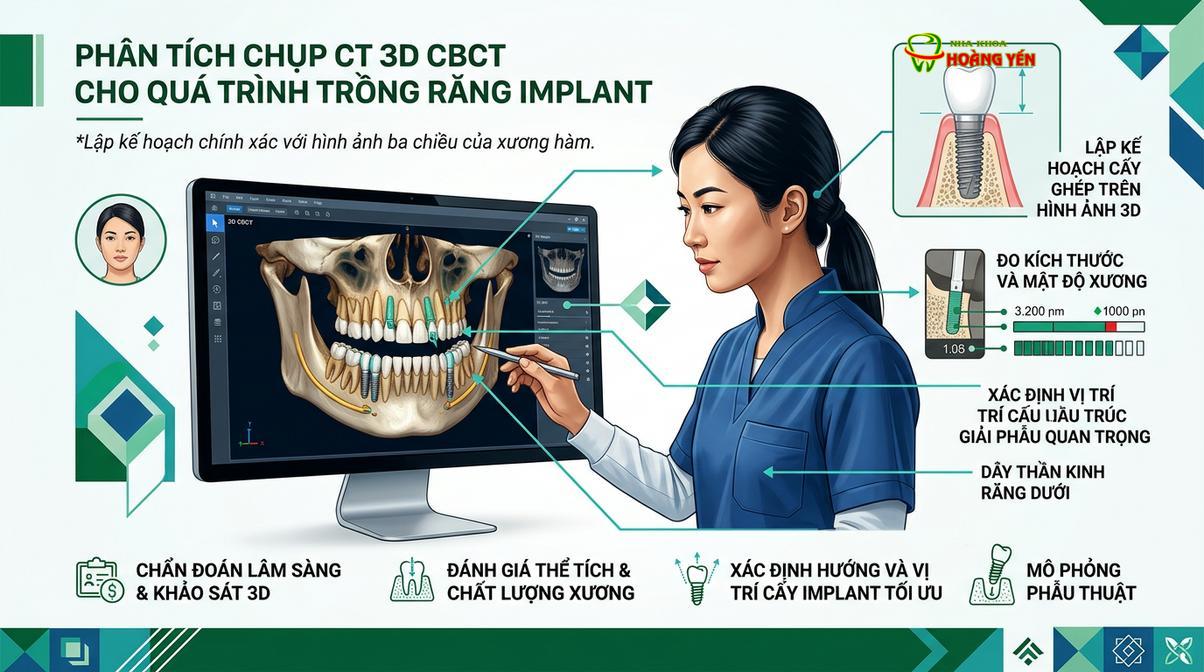 Bác sĩ đánh giá mật độ xương hàm qua phim CT Cone Beam 3D để lập phác đồ phẫu thuật chuẩn xác.