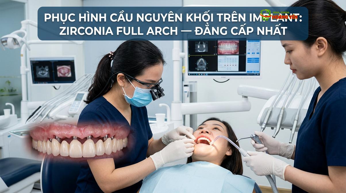 Cầu răng Zirconia nguyên khối trên implant mang lại độ cứng chắc và thẩm mỹ vượt trội.