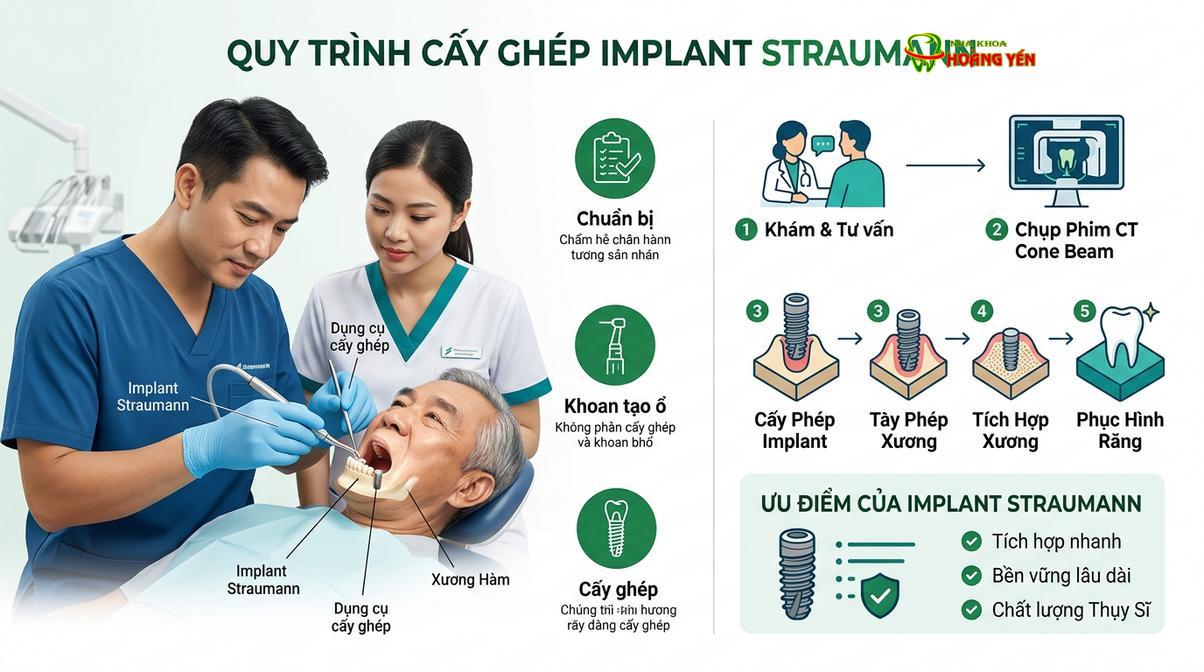 Lựa chọn dòng trụ implant cao cấp giúp tăng tỷ lệ tích hợp xương thành công.