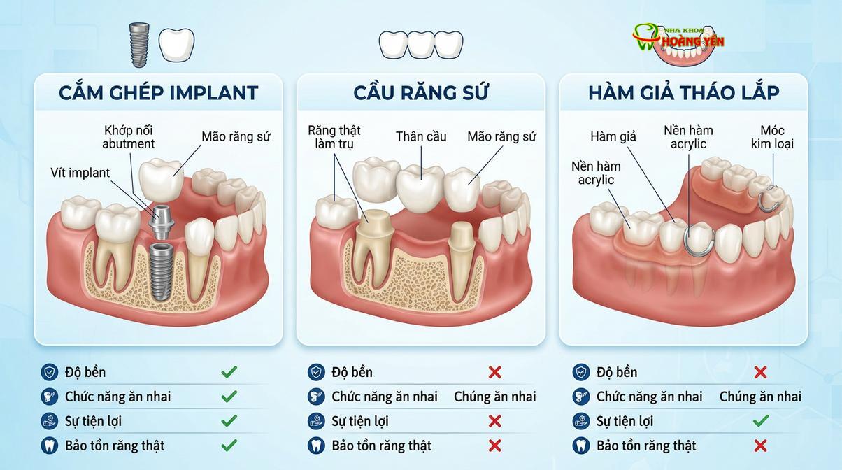 So sánh sự khác biệt về khả năng bảo tồn xương hàm giữa phương pháp cấy ghép implant và các phương pháp truyền thống.