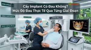 Cấy Implant Có Đau Không? Mức Độ Đau Thực Tế Qua Từng Giai Đoạn
