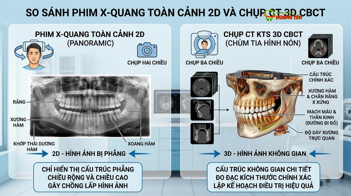 Sự khác biệt về mức độ chi tiết giữa phim X-quang 2D thông thường và phim 3D CBCT.