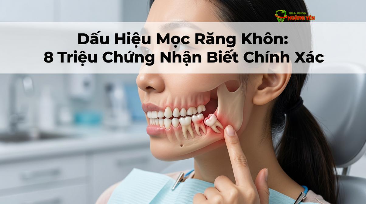 Đau nhức vùng góc hàm là một trong những triệu chứng lâm sàng điển hình nhất khi răng số 8 bắt đầu nhú lên.