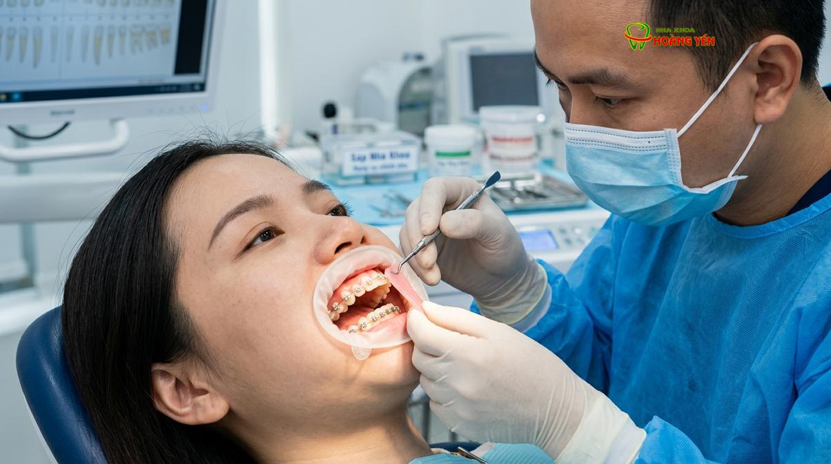 Sử dụng sáp nha khoa là biện pháp hiệu quả giúp bảo vệ niêm mạc miệng khỏi trầy xước