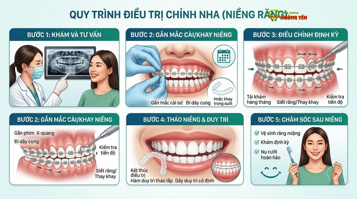 Quy trình chỉnh nha chuẩn y khoa đòi hỏi sự chính xác trong từng giai đoạn chẩn đoán và điều trị.