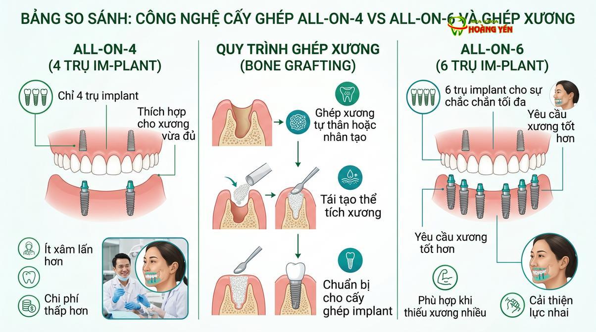 Mô phỏng kỹ thuật cấy ghép toàn hàm kết hợp tái tạo xương