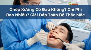 Visual illustration of ghép xương có đau không