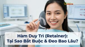 Visual illustration of hàm duy trì sau niềng