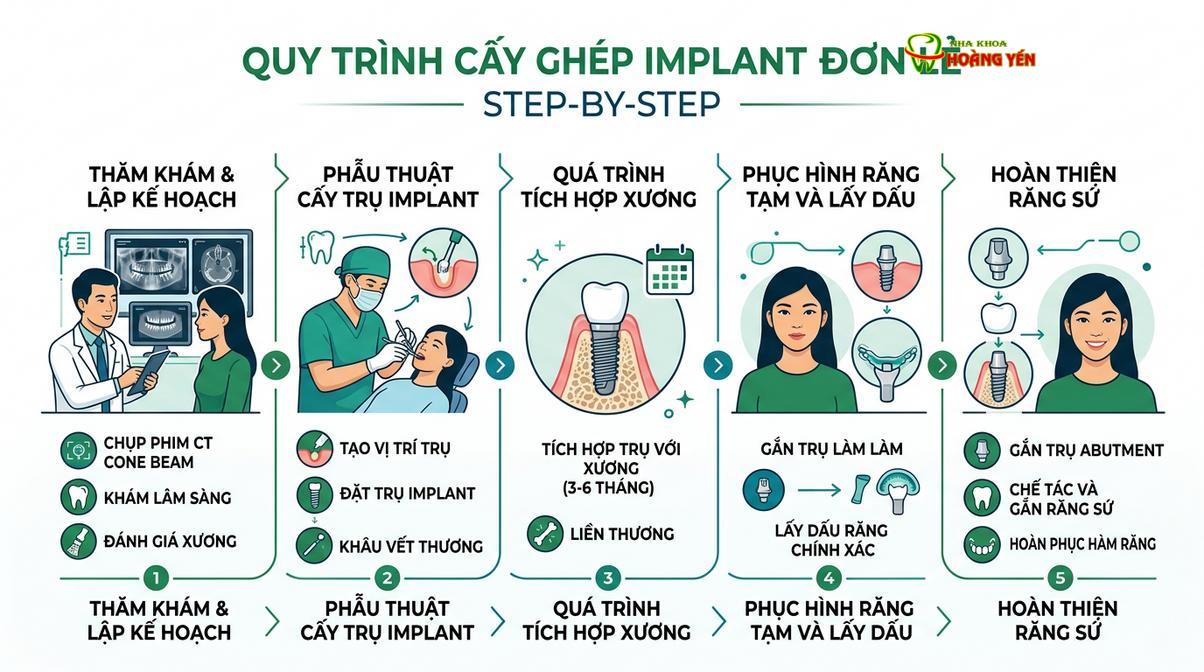 Quy trình cấy ghép implant chuẩn y khoa giúp giảm thiểu sang chấn và hỗ trợ lành thương tốt.