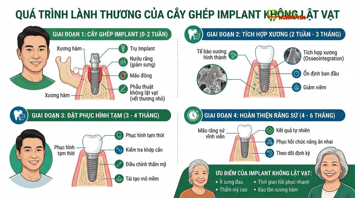 Quá trình lành thương diễn ra thuận lợi nhờ việc bảo tồn hệ thống mạch máu quanh răng.