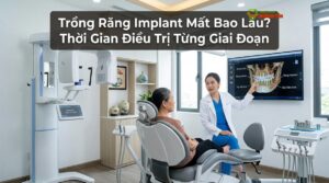 Trồng Răng Implant Mất Bao Lâu? Thời Gian Điều Trị Từng Giai Đoạn