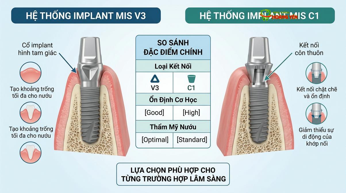Sự khác biệt trong thiết kế vùng cổ giữa các dòng trụ MIS giúp đáp ứng đa dạng chỉ định lâm sàng.
