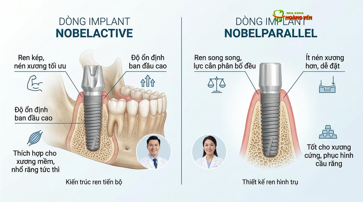 So sánh thiết kế ren xoắn giữa dòng NobelActive và NobelParallel