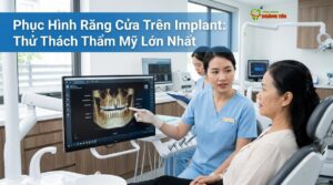 Phục Hình Răng Cửa Trên Implant: Thử Thách Thẩm Mỹ Lớn Nhất