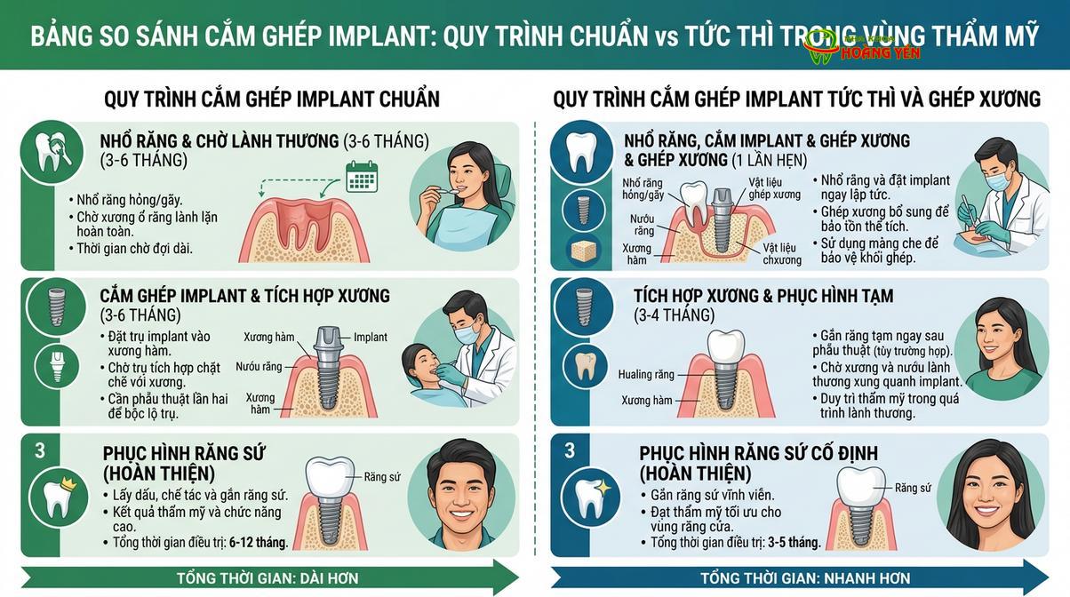 Sơ đồ minh họa kỹ thuật ghép xương và xử lý mô mềm nhằm bảo tồn cấu trúc nướu vùng thẩm mỹ.