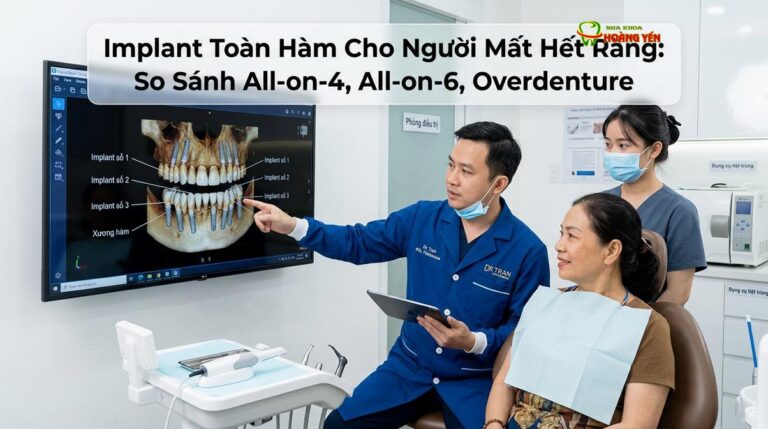 Implant Toàn Hàm Cho Người Mất Hết Răng: So Sánh All-on-4, All-on-6, Overdenture