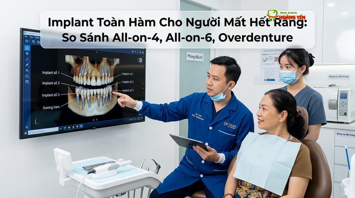 Bác sĩ đánh giá cấu trúc xương hàm qua phim CT Cone Beam 3D trước khi lên phác đồ cấy ghép toàn hàm.