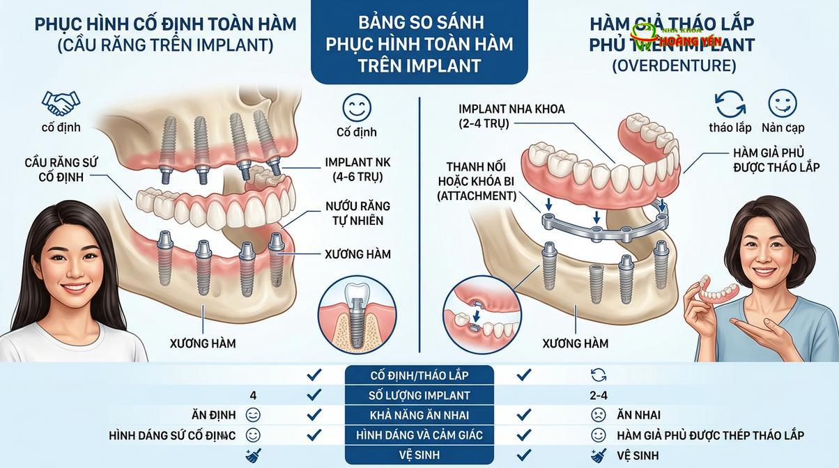 Sự khác biệt cơ bản giữa hàm cố định trên implant và hàm phủ overdenture.