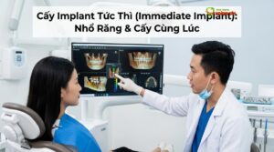 Visual illustration of implant tức thì
