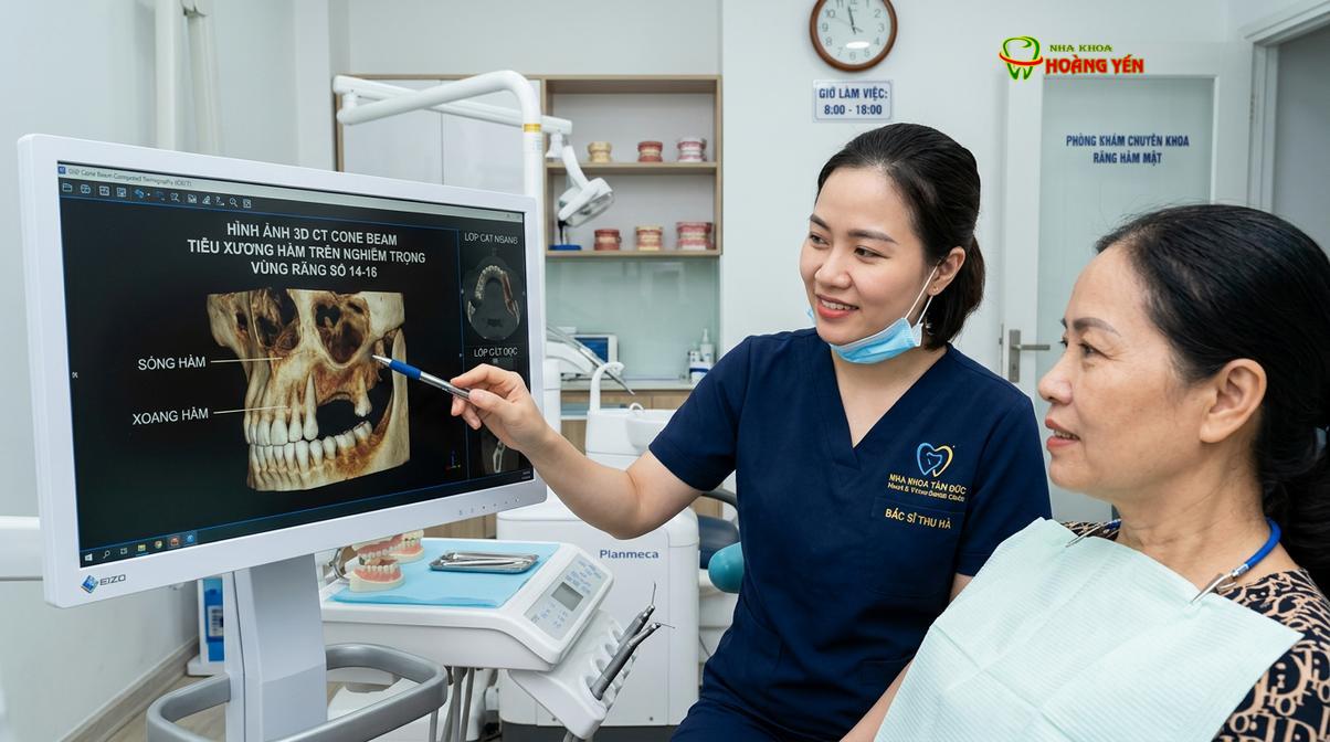 Bác sĩ đánh giá mức độ tiêu xương hàm trên qua phim chụp CT Cone Beam 3D trước khi lên phác đồ điều trị.