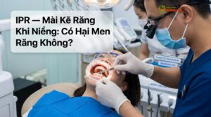 Visual illustration of IPR mài kẽ răng