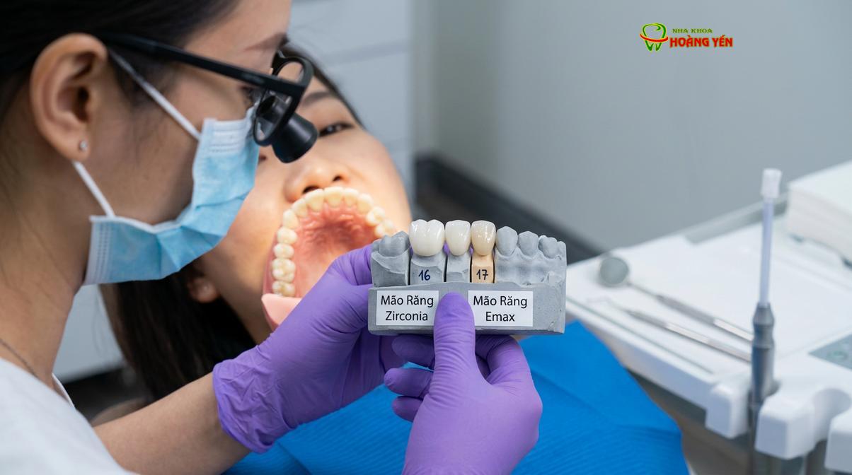 Sự khác biệt về độ trong mờ và tính thẩm mỹ giữa các dòng vật liệu sứ nha khoa cao cấp.