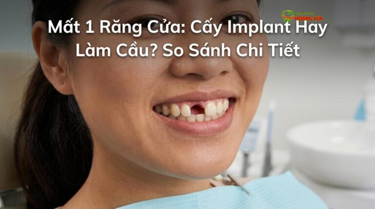 Mất 1 Răng Cửa: Cấy Implant Hay Làm Cầu? So Sánh Chi Tiết