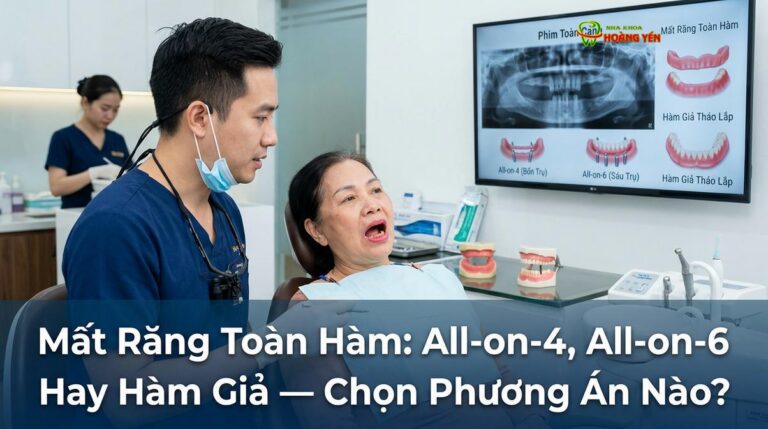 Mất Răng Toàn Hàm: All-on-4, All-on-6 Hay Hàm Giả — Chọn Phương Án Nào?