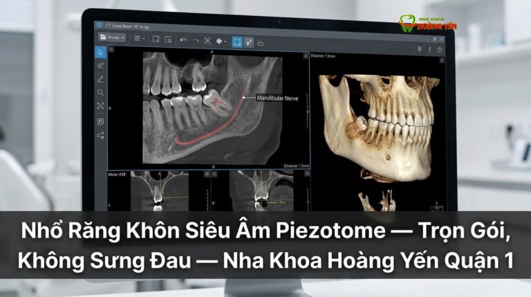 Nhổ Răng Khôn Siêu Âm Piezotome — Trọn Gói, Không Sưng Đau — Nha Khoa Hoàng Yến Quận 1