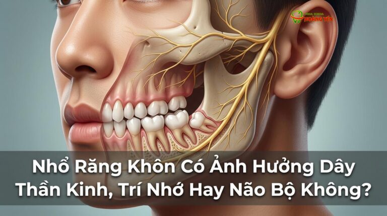 Nhổ Răng Khôn Có Ảnh Hưởng Dây Thần Kinh, Trí Nhớ Hay Não Bộ Không?