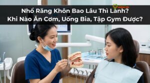 Visual illustration of nhổ răng khôn bao lâu thì lành