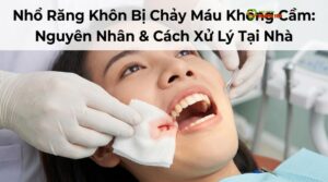 Visual illustration of nhổ răng khôn chảy máu
