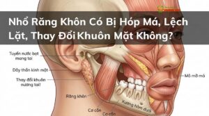 Nhổ Răng Khôn Có Bị Hóp Má, Lệch Mặt, Thay Đổi Khuôn Mặt Không?