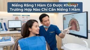 Niềng Răng 1 Hàm Có Được Không? Trường Hợp Nào Chỉ Cần Niềng 1 Hàm