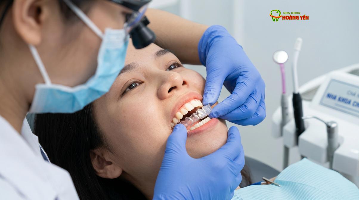 Niềng răng trong suốt Invisalign là một trong những giải pháp thẩm mỹ và hiệu quả để điều trị cắn hở.