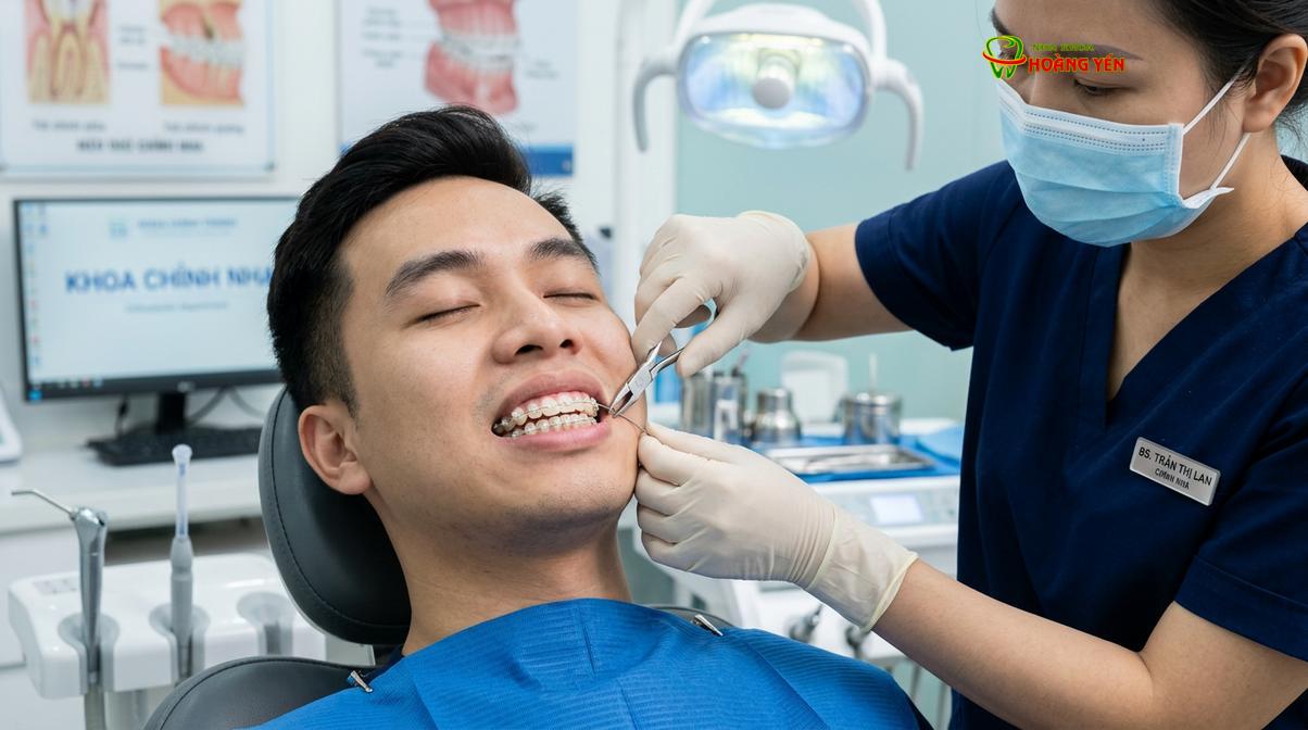 Quá trình siết dây cung định kỳ được thực hiện nhẹ nhàng, lực tác động được kiểm soát chặt chẽ để hạn chế tối đa sự khó chịu cho bệnh nhân.
