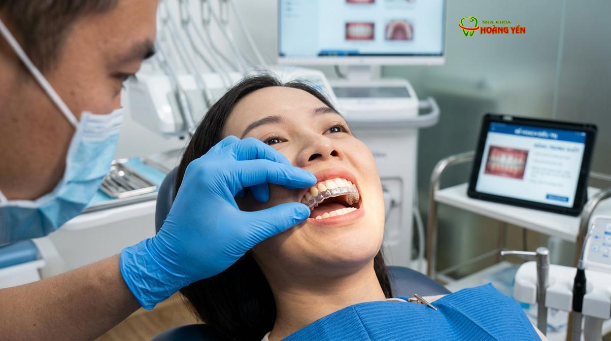 Niềng răng trong suốt Invisalign là giải pháp được nhiều người trưởng thành lựa chọn khi tái niềng.