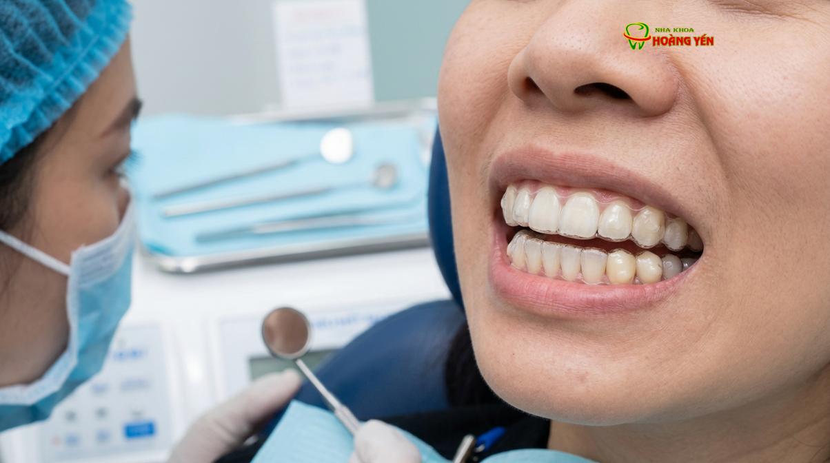 Sơ đồ so sánh hai hướng điều trị chính: Đóng khoảng bằng răng thật và Tạo khoảng để cấy ghép Implant.