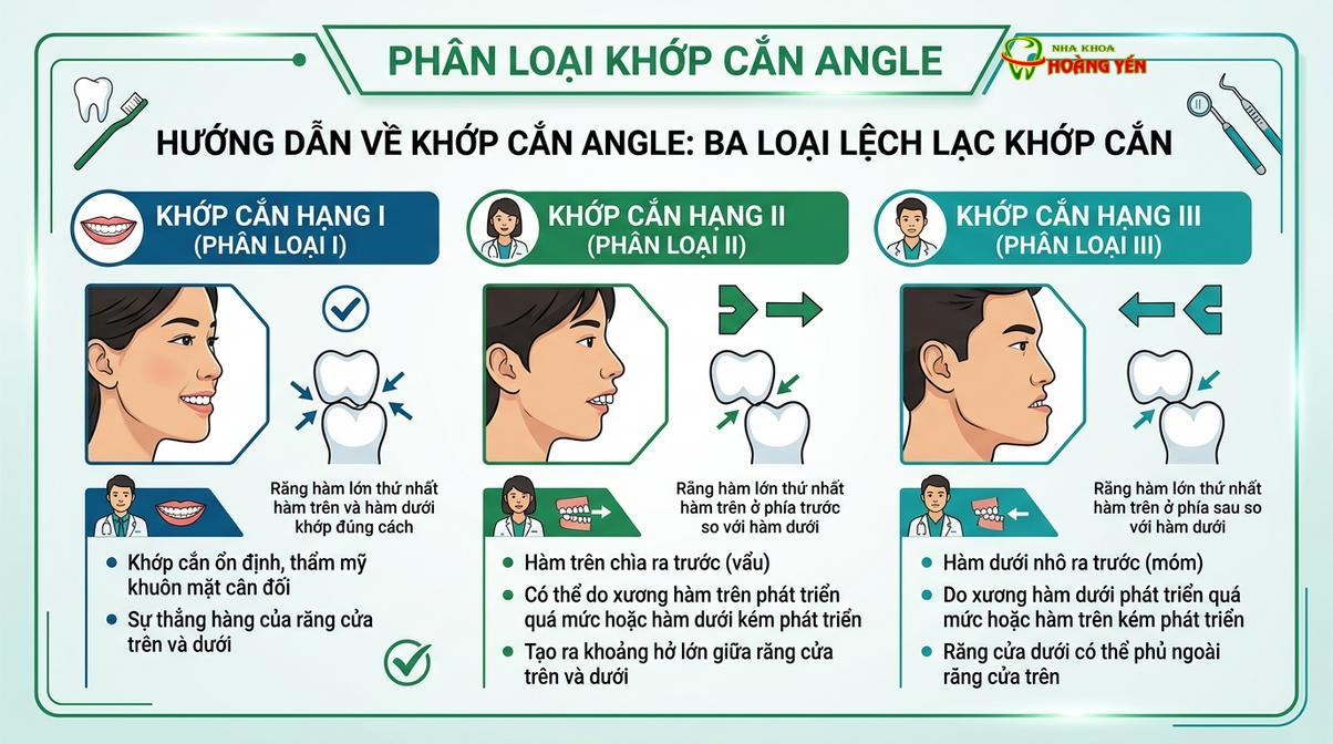 Phân loại sai khớp cắn Angle giúp bác sĩ xác định chính xác mức độ lệch lạc của xương hàm và răng.