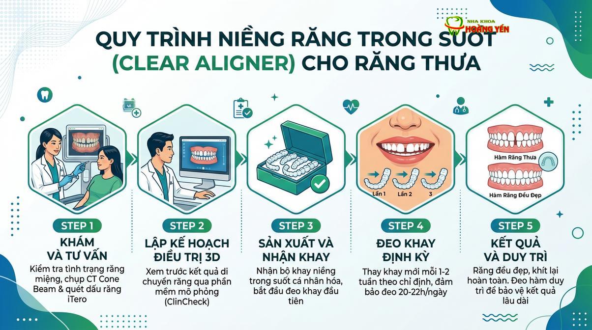 Khay niềng trong suốt mang lại sự tiện lợi và thẩm mỹ cao cho bệnh nhân răng thưa.
