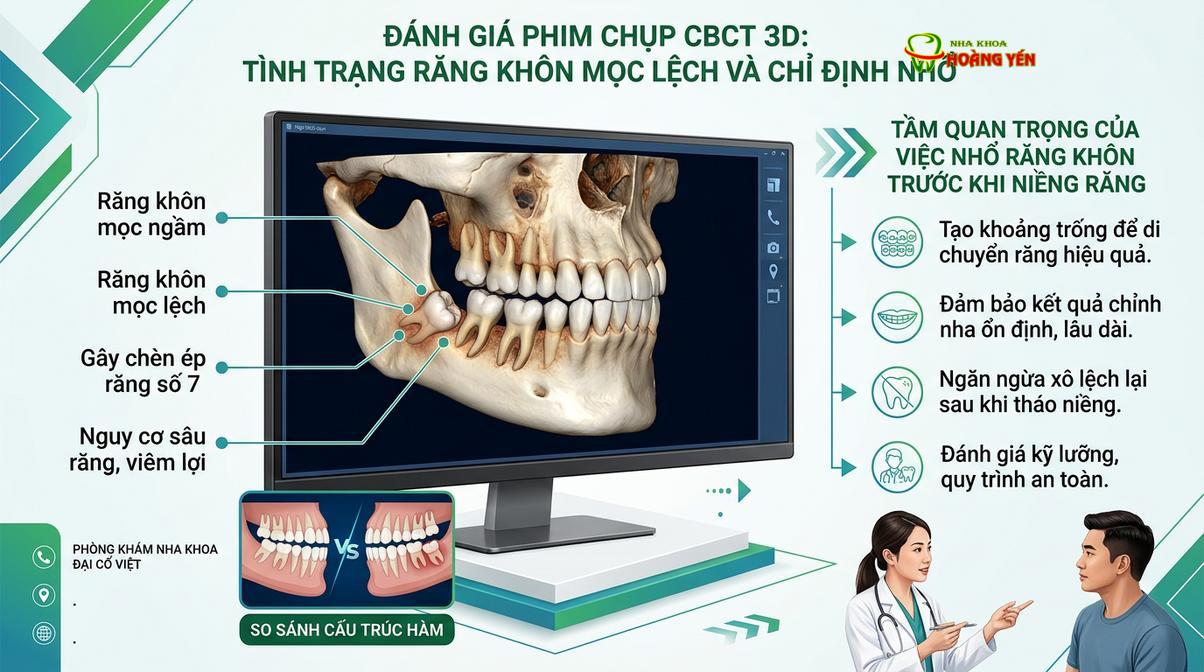 Khảo sát phim X-quang 3D để đánh giá tình trạng răng khôn trước khi lên phác đồ chỉnh nha.