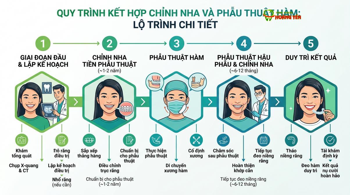 Sơ đồ tóm tắt các giai đoạn điều trị kết hợp giữa niềng răng và phẫu thuật hàm.