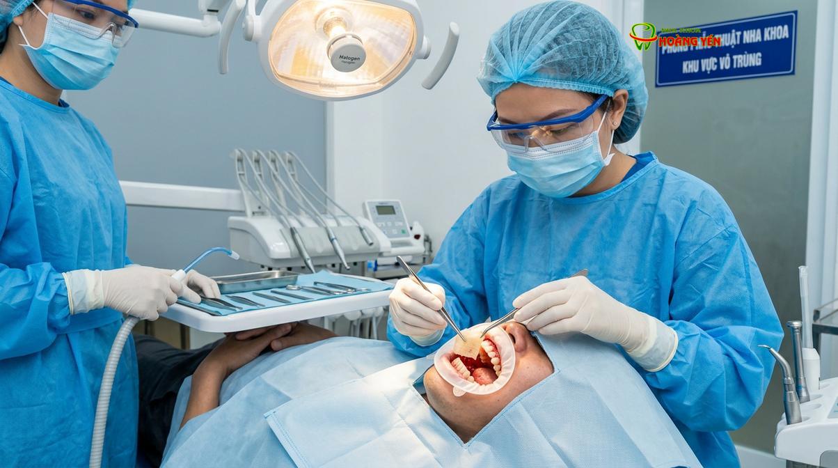 Ứng dụng màng PRF trực tiếp lên vùng phẫu thuật implant giúp bảo vệ vết thương.
