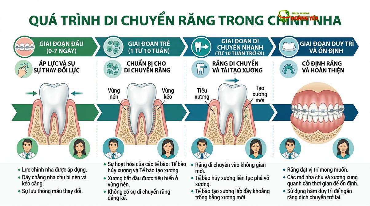 Sự dịch chuyển của răng là kết quả của quá trình tiêu xương và bồi đắp xương liên tục.