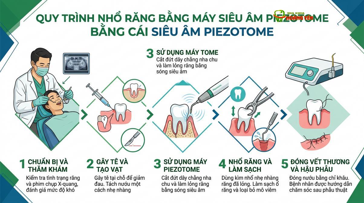 Công nghệ sóng siêu âm Piezotome hỗ trợ bóc tách chân răng khôn nhẹ nhàng, hạn chế tổn thương mô mềm.